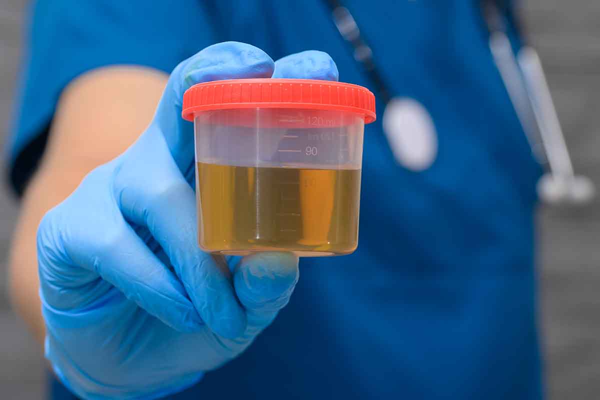 How to prevent uti & why you keep getting it