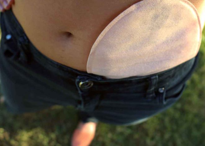 What is ostomy? Caregiver Guide