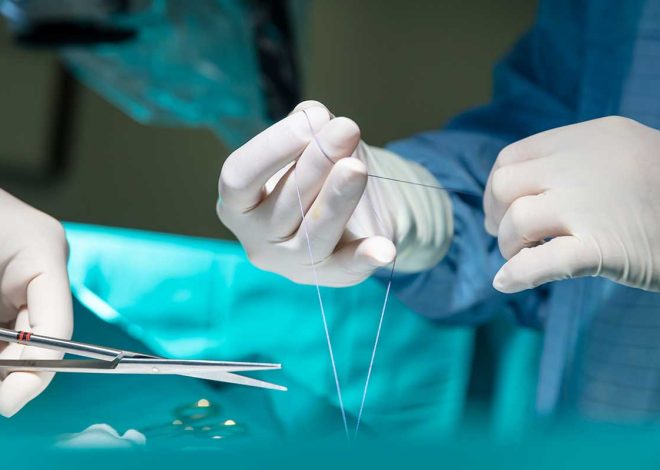 Stitches vs seams: guide